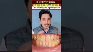 How to clean yellow teeth  ਪੀਲੇ ਦੰਦ ਸਾਫ ਕਿਦਾ ਕਰੀਏ  welltvpunjab shorts [upl. by Gaultiero]