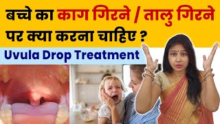 बच्चे का काग गिरने  तालु गिरने पर क्या करे। uvula droping  bache ka kag girna [upl. by Enrico]