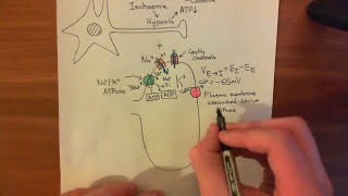 Strokes and Excitotoxicity Part 2 [upl. by Alper]