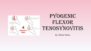 Pyogenic flexor tenosynovitis  epidemiology causes Kanavel signs imaging treatment [upl. by Eocsor]