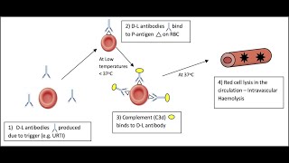 Paroxysmal Cold hemoglobinuria  Donath Landsteiner Hemolytic Anemia or Syndrome [upl. by Beaufert]