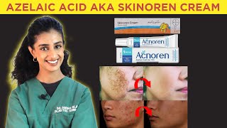 All about Azelaic acid  Skinoren cream review  Dr Hirra Alavi [upl. by Julianne]