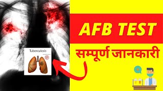 Acid Fast Bacilli Test Procedure  AFB Test for TB in Hindi [upl. by Dleifxam]