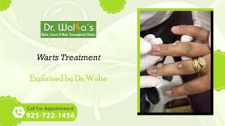 Warts Removal I Warts Treatment I How To Get Rid Of Warts [upl. by Ubana363]