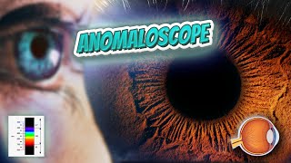 Anomaloscope  Your EYEBALLS  EYNTK 👁️💉😳💊🔊💯✅ [upl. by Amla]