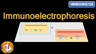 Immunoelectrophoresis FLImmuno59 [upl. by Nahtaneoj]