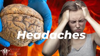 What is Causing Your Headaches [upl. by Schilling]