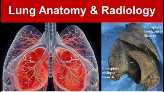 Lung Anatomy amp Radiology Gross Features Surfaces Borders and Azygous Lobe Part 1 TaimTalksMed [upl. by Glover888]