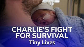 Baby Charlies Fight For Survival  Tiny Lives  BBC Scotland [upl. by Reggi]