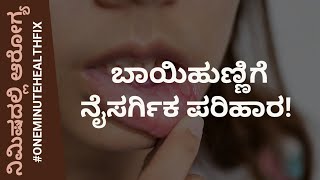 ನಿಮಿಷದಲ್ಲಿ ಆರೋಗ್ಯ  454  MOUTH ULCER  DR VENKATRAMANA HEGDE  NISARGA MANE  SIRSI [upl. by Nannaihr]