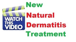 Stasis dermatitis treatment Dermatology doctor Dermatology specialist [upl. by Neila]