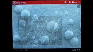 mVision  A Microscopic App for Android [upl. by Sukul]