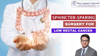 Sphincter Preservation Surgery for low Rectal Cancer  Dr Vinay Samuel Gaikwad  Surgical Oncologist [upl. by Latrina286]