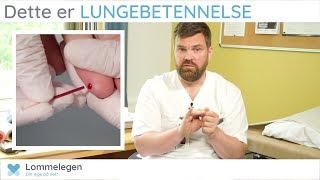 Dette er LUNGEBETENNELSE  Lommelegen  Lungesykdommer [upl. by Rexferd]