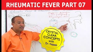 Rheumatic Fever amp Heart Disease Part 77 [upl. by Narut]