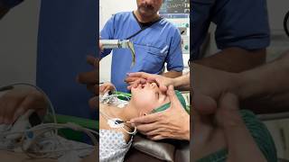 Colostomy reversal Under General Anesthesia shortvideo youtubeshorts [upl. by Harras714]