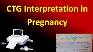 Interpretation of Cardiotocography for Assessment of Fetal Wellbeing NICE Guideline [upl. by Amahs]