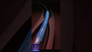 Coronary Artery Stent animation shorts heartstent [upl. by Drais]