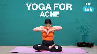 Yoga for Skin Problems  Yoga Poses to Treat Acne amp Pigmentation  Day 24 Yog Sutra Challenge [upl. by Rima599]