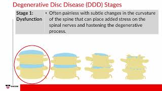 Injuries of the Spine [upl. by Bethesda]