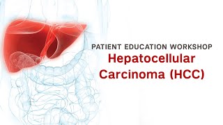 Workshop  Hepatocellular Carcinoma HCC [upl. by Remo]