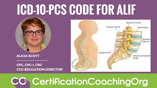 ICD10PCS Code for ALIF Anterior Lumbar Interbody Fusion Procedure [upl. by Notsnarc]