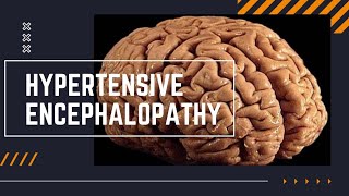 HYPERTENSIVE ENCEPHALOPATHY  MALIGNANT HYPERTENSION  ENCEPHALOPATHY  BRAIN DYSFUNCTION [upl. by Yerga108]