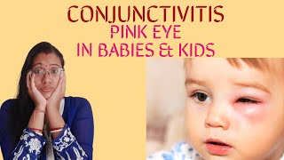 CONJUNCTIVITIS PINK EYE IN BABIES N KIDS CAUSE SIGNS PREVENTION AND TREATMENT [upl. by Ennyroc]