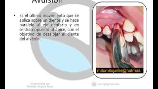 FISTUBE Odontología y Estática 01 Exodoncia versión 10 [upl. by Maurizia153]