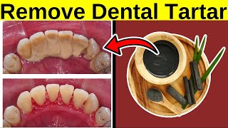 Remove Dental Tartar At Home NATURALLY [upl. by Oxford]