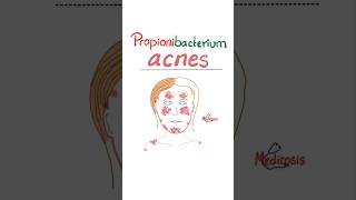 Propionibacterium acnes  Acne Vulgaris  Microbiology science microbiology nurse doctor mbbs [upl. by Nylzor447]