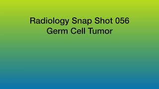 Germ Cell Tumor [upl. by Yrian]