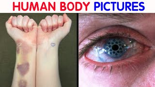 “My Eye Is Gradually Losing Its Color” 50 Interesting Human Body Pics [upl. by Treborsemaj]