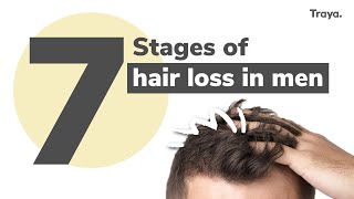 7 Stages of Hair Loss in Men  Right Time to Start the Treatment  Hair Regrowth  Traya Health [upl. by Alford]