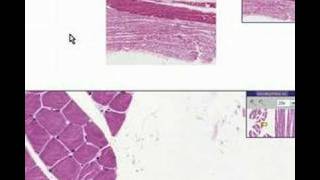 Histopathology Skeletal muscleAtrophy [upl. by Yatnahs801]