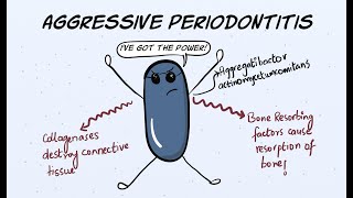 Aggressive Periodontitis Part 1  Etiology and Pathogenesis [upl. by Asylem508]