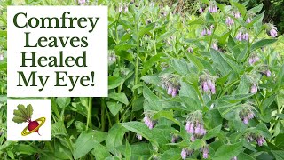 Comfrey Leaves Healed My Eye [upl. by Ylyl]