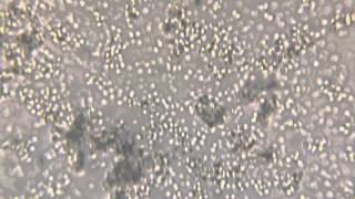 4K video of yeast Saccharomyces cerevisiae seen at 100x magnification [upl. by Metsky184]