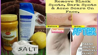 HOME REMEDY BEST AND EFFECTIVE FOR WHITENING ARMPiT AND REMOVING DARK SPOT  MarYaan Vlogs [upl. by Brest]