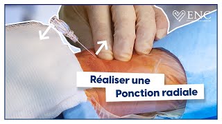 Tuto ENC  comment réaliser une ponction radiale  animation 3D [upl. by Ynnav775]