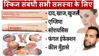 Terbinaforce lite cream  Terbinaforce cream use in Hindi  Terbinaforce Cream For Skin Whitening [upl. by Lillith]