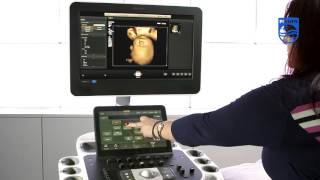 How to Perform a 4D Acquisition on a Philips EPIQ Ultrasound System [upl. by Sorazal]