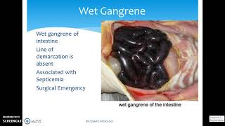 DIFFERENT TYPES OF GANGRENE [upl. by Melessa]