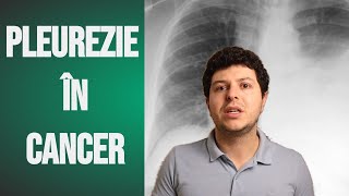 Pleureziile în cancer apa la plămâni [upl. by Aiykan]