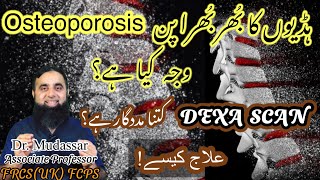 Understand Osteoporosis with Accurate information  Causes Diagnosis amp Treatment [upl. by Ailekahs2]