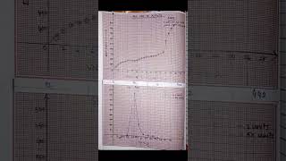 Potentiometric Titration of Fe2 with K2Cr2O7 chemistryexperiments [upl. by Hylan]