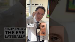 Is the Fox Eye Brow Lift Right for You Dr Litner Reveals the Perfect Candidate [upl. by Loraine679]