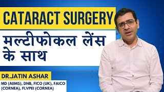 मल्टीफोकल लेंस के साथ मोतियाबिंद ऑपरेशन  जानिये फायदे ओर नुकसान  Cataract with Multifocal IOL [upl. by Myke]