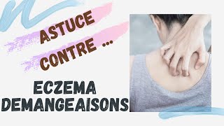 🛑 STOP AUX DEMANGEAISONS 🛑  ECZEMA PSIORASIS [upl. by Arlynne]