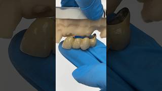 Replacing an Old Bridge EnvisiontecMain envisiontec lsk121shorts dental teeth [upl. by Kreitman]